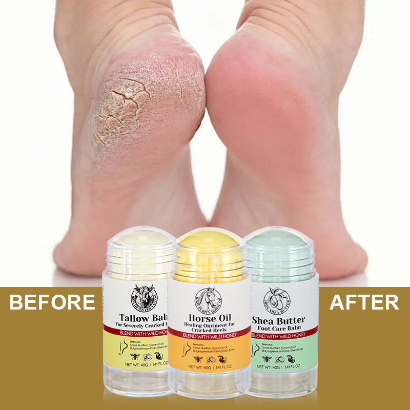 Beeswax Dead Skin Foot Callus Remover Foot Cream Care Stick Cracked Heel Repair Whipped Beef Tallow for Dry Feet - 8